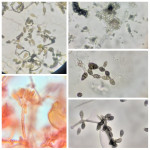 Identificación de microorganismos: Alternariaspp., Penicilliumspp., Aspergillus spp. y Curvulariaspp.
