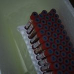 Refrigeración de las muestras en una conservadora a una temperatura controlada entre 2 a 8°C (grados Celsius), para su posterior envío y estudio a un laboratorio